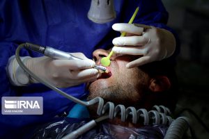 پژوهشگران برای چالش اصلاح سطح تجهیزات دندانپزشکی با پوشش DLC دعوت شدند